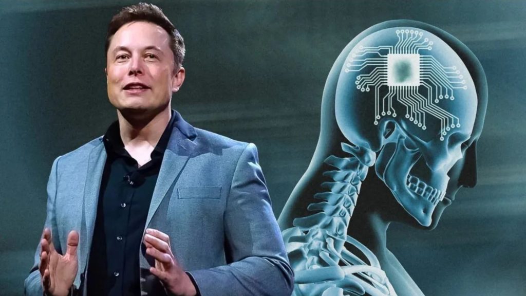 Elon Musk's Brain Tech: Ethical Concerns Around Neuralink
