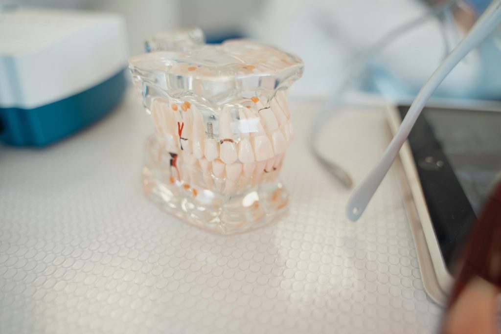 dental crowns